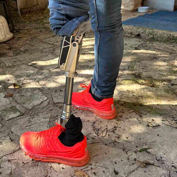 ORTOSTAR - SPECIJALIZIRANA IZRADA ORTOPEDSKIH POMAGALA